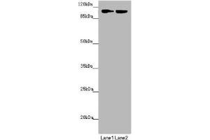 Western blot All lanes: HK3 antibody at 1. (HK3 Antikörper  (AA 1-270))