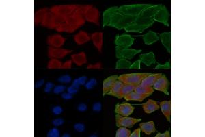 ABIN6258774 and ABIN6274538 staining Hela cells(30 min of UV treatment) by IF/ICC. (EPH Receptor A6 Antikörper  (C-Term))