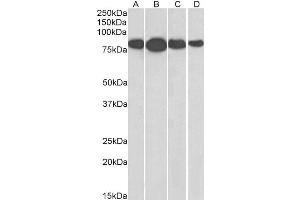 Radixin Antikörper  (Internal Region)