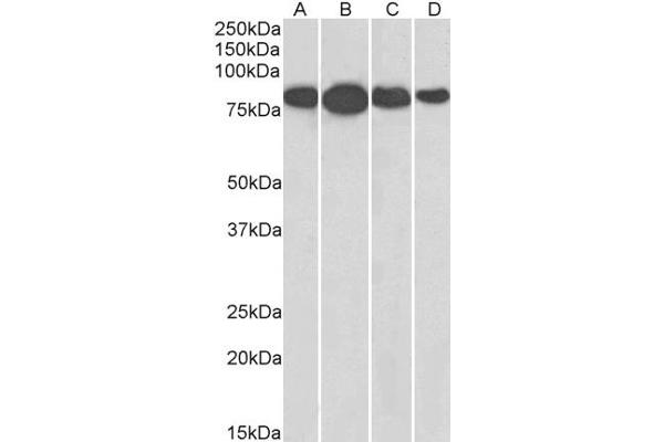 Radixin Antikörper  (Internal Region)