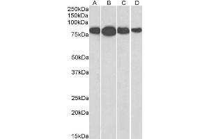 ABIN185665 (0. (Radixin Antikörper  (Internal Region))