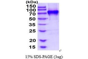 SDS-PAGE (SDS) image for CD93 (CD93) (AA 22-580) protein (His tag) (ABIN6387845)