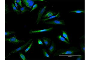 Immunofluorescence of purified MaxPab antibody to MMAB on HeLa cell. (MMAB Antikörper  (AA 1-250))