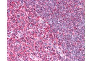HSPA8 antibody was used for immunohistochemistry at a concentration of 4-8 ug/ml. (Hsc70 Antikörper  (N-Term))