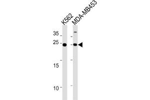 Western Blotting (WB) image for anti-Sarcospan (Kras Oncogene-Associated Gene) (SSPN) antibody (ABIN3004662)
