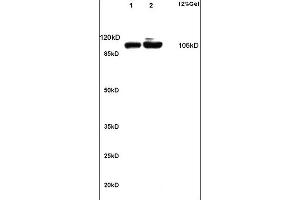 Lane 1: rat kidney lysates Lane 2: rat brain lysates probed with Anti alpha Actinin 4 Polyclonal Antibody, Unconjugated (ABIN733778) at 1:200 in 4 °C. (alpha Actinin 4 Antikörper)