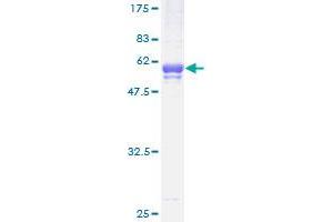 Image no. 2 for Testis-Specific Serine Kinase 3 (TSSK3) (AA 1-268) protein (GST tag) (ABIN1323981)