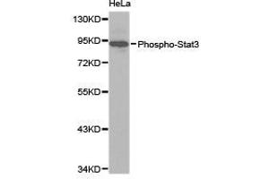Western Blotting (WB) image for anti-Signal Transducer and Activator of Transcription 3 (Acute-Phase Response Factor) (STAT3) (pTyr705) antibody (ABIN1876745) (STAT3 Antikörper  (pTyr705))