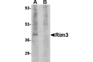 Western Blotting (WB) image for anti-Regulating Synaptic Membrane Exocytosis 3 (RIMS3) (N-Term) antibody (ABIN1031542) (RIMS3 Antikörper  (N-Term))