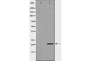 Western blot analysis of brain  lysate using KRAS antibody. (K-RAS Antikörper  (C-Term))