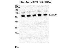 Western Blot (WB) analysis of specific cells using ATP5A Polyclonal Antibody. (ATP5G1 Antikörper  (Internal Region))
