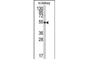 Western blot analysis of anti-ALDH9A1 Antibody (N-term) (ABIN6242161 and ABIN6579017) in mouse kidney tissue lysates (35 μg/lane). (ALDH9A1 Antikörper  (N-Term))