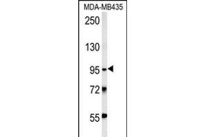 TRHDE Antibody (C-term) (ABIN651822 and ABIN2840414) western blot analysis in MDA-M cell line lysates (15 μg/lane). (TRHDE Antikörper  (C-Term))