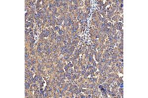 IHC analysis of SH2D4A using anti-SH2D4A antibody (ABIN7601695).