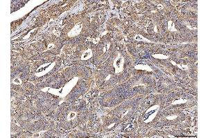 IHC analysis of ACADM/MCAD using anti-ACADM/MCAD antibody (ABIN7601543). (Medium-Chain Specific Acyl-CoA Dehydrogenase, Mitochondrial (MCAD) (AA 38-401) Antikörper)