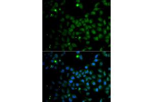 Immunofluorescence analysis of A549 cells using SMAD9 antibody (ABIN5975592). (SMAD9 Antikörper)
