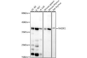 Western blot analysis of extracts of various cell lines, using R antibody (ABIN7269858) at 1:500 dilution.
