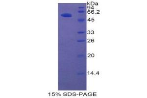 SDS-PAGE (SDS) image for Hepatocyte Growth Factor Activator (HGFA) (AA 363-622) protein (His tag,GST tag) (ABIN1877309) (HGFA Protein (AA 363-622) (His tag,GST tag))