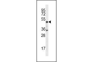 DSN1 Antibody (C-term) (ABIN656747 and ABIN2845971) western blot analysis in MDA-M cell line lysates (35 μg/lane). (DSN1 Antikörper  (C-Term))
