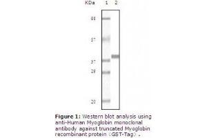 Image no. 2 for anti-Myoglobin (MB) antibody (ABIN207623) (Myoglobin Antikörper)