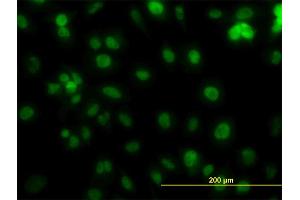 Immunofluorescence of monoclonal antibody to PCNA on HeLa cell. (PCNA Antikörper  (AA 1-261))