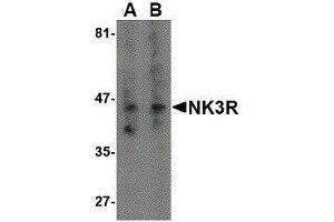 Western Blotting (WB) image for anti-Tachykinin Receptor 3 (TACR3) antibody (ABIN2476672) (TACR3 Antikörper)
