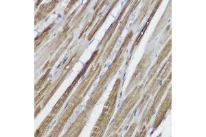 Immunohistochemistry (IHC) image for anti-Galactosidase, beta 1 (GLB1) (AA 1-270) antibody (ABIN3015643)