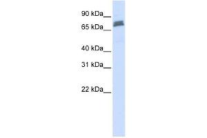 TRIM45 antibody used at 1 ug/ml to detect target protein. (TRIM45 Antikörper  (N-Term))
