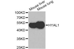 Western blot analysis of extracts of various cell lines, using HYAL1 Antibody.