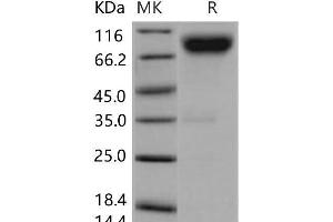 Western Blotting (WB) image for CD200 Receptor 4 (CD200R4) protein (Fc Tag) (ABIN7320209) (CD200R4 Protein (Fc Tag))