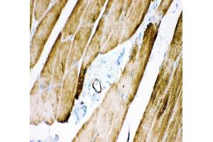 IHC analysis of Desmin using anti-Desmin antibody (ABIN3043265).