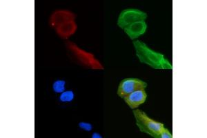 anti-Ring Finger Protein 125 (RNF125) (Internal Region) antibody