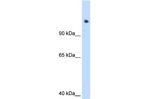WB Suggested Anti-SMARCAL1 Antibody Titration:  1. (SMARCAL1 Antikörper  (C-Term))