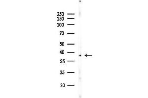 anti-Docking Protein 4 (DOK4) (N-Term) antibody