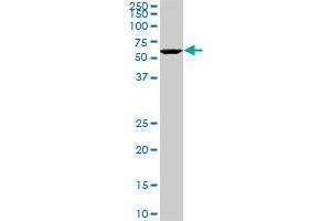 USP14 monoclonal antibody (M08), clone 1F8. (USP14 Antikörper  (AA 395-494))