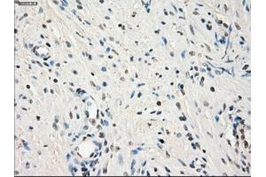 Immunohistochemical staining of paraffin-embedded endometrium tissue using anti-LTA4Hmouse monoclonal antibody. (LTA4H Antikörper)