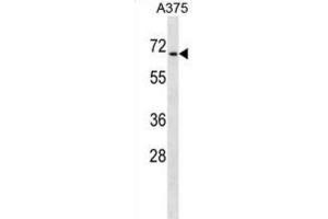 Western Blotting (WB) image for anti-Chromodomain Protein, Y-Like (CDYL) antibody (ABIN2998873)