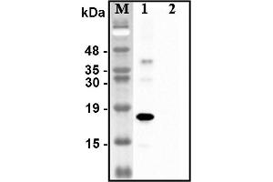 Western blot analysis of recombinant human CTRPs using anti-CTRP1 (human), pAb  at 1:4,000 dilution. (C1QTNF1 Antikörper)