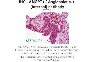 Image no. 1 for anti-Angiopoietin 1 (ANGPT1) (Internal Region) antibody (ABIN1731781) (Angiopoietin 1 Antikörper  (Internal Region))