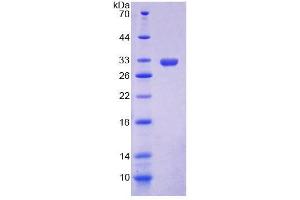 SDS-PAGE (SDS) image for Nuclear Receptor Subfamily 1, Group I, Member 3 (NR1I3) (AA 1-247) protein (His tag) (ABIN6239088)