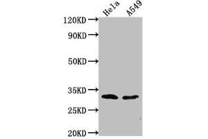 Western Blot Positive WB detected in: Hela whole cell lysate, A549 whole cell lysate All lanes: VAX2 antibody at 1:2000 Secondary Goat polyclonal to rabbit IgG at 1/50000 dilution Predicted band size: 31 kDa Observed band size: 31 kDa (VAX2 Antikörper  (AA 1-74))