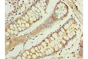 Immunohistochemistry of paraffin-embedded human colon tissue using ABIN7146811 at dilution of 1:100 (CEACAM8 Antikörper  (AA 35-320))