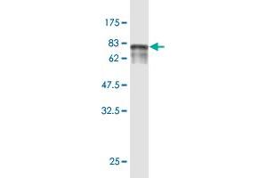 Western Blot detection against Immunogen (75. (ENPP5 Antikörper  (AA 24-477))