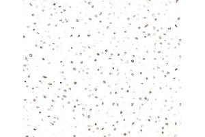 Immunocytochemistry (ICC) image for anti-Interferon, gamma-Inducible Protein 16 (IFI16) (AA 350-400) antibody (ABIN7795821)