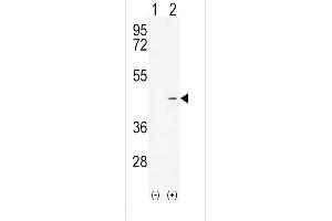 Western Blotting (WB) image for anti-Alcohol Dehydrogenase 4 (Class II), pi Polypeptide (ADH4) (AA 319-348), (C-Term) antibody (ABIN654087)