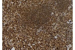 ABIN6257848 and ABIN6273703 at 1/100 staining Mouse spleen tissue by IHC-P.