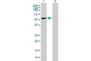 Western Blot analysis of ZNF232 expression in transfected 293T cell line by ZNF232 MaxPab polyclonal antibody. (ZNF232 Antikörper  (AA 1-444))