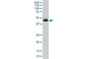 TNFRSF10A monoclonal antibody (M01), clone 2E8 Western Blot analysis of TNFRSF10A expression in K-562 . (TNFRSF10A Antikörper  (AA 105-204))
