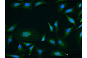 Immunofluorescence of purified MaxPab antibody to PRKD1 on HeLa cell. (PKC mu Antikörper  (AA 1-912))