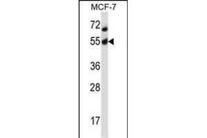 Mouse Akt2 Antibody (N-term) (ABIN657827 and ABIN2846794) western blot analysis in MCF-7 cell line lysates (35 μg/lane). (AKT2 Antikörper  (N-Term))